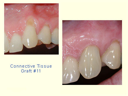 GingAug_case01