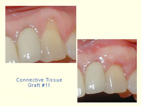 GingAug_case05
