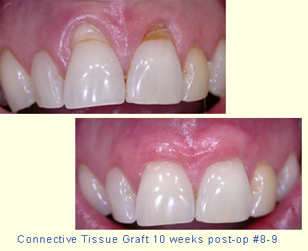 GingAug_case08