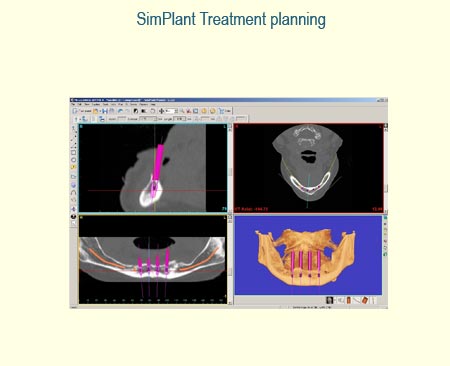 Full Arch Case Study