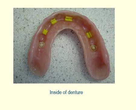 Full Arch Case Study
