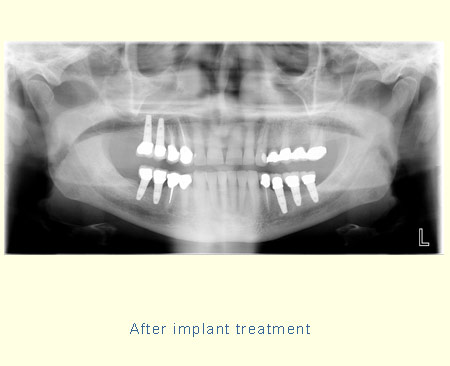 Belmont Periodontics