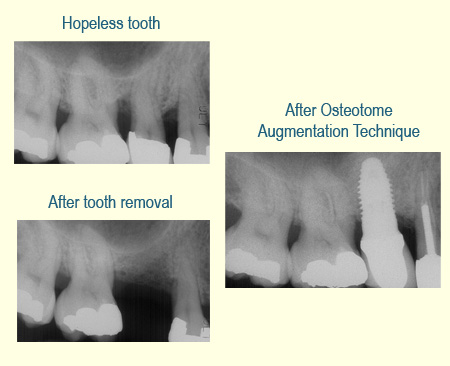 Belmont Periodontics