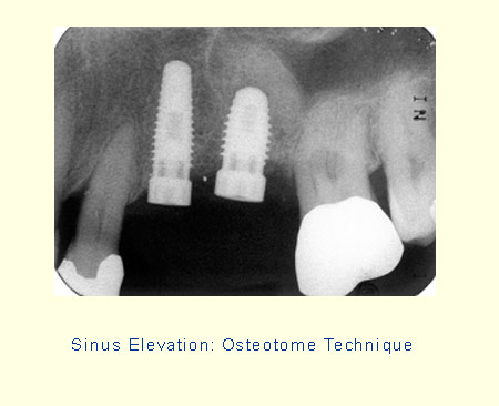 Belmont Periodontics