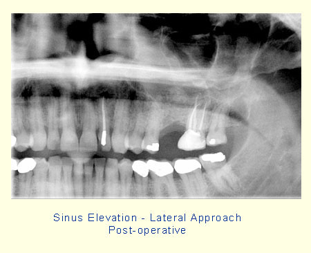 Belmont Periodontics