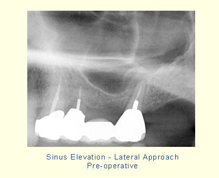 Belmont Periodontics