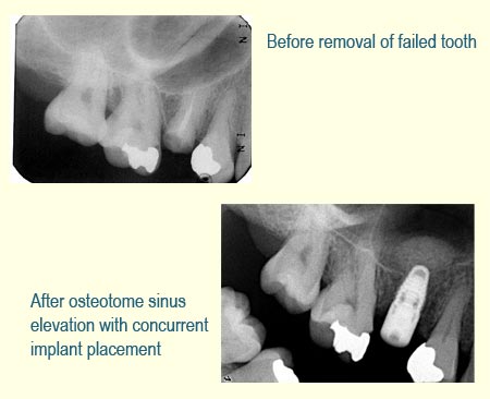 Belmont Periodontics