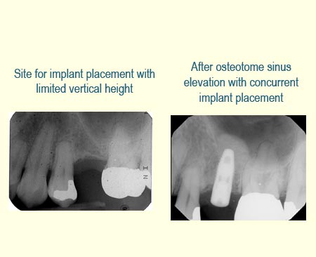 Belmont Periodontics