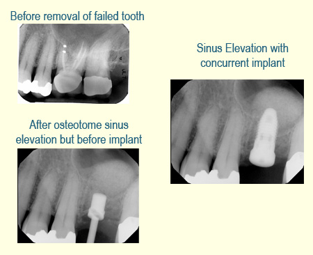 Belmont Periodontics
