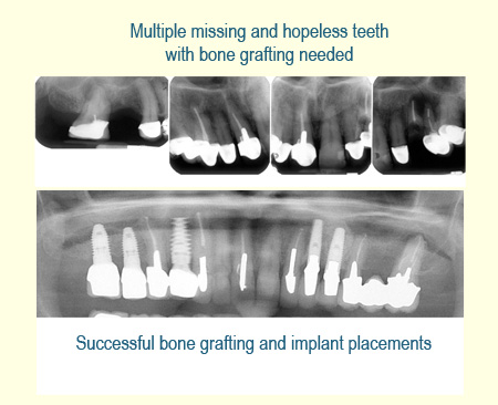 Belmont Periodontics