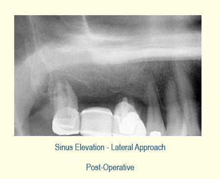 Belmont Periodontics