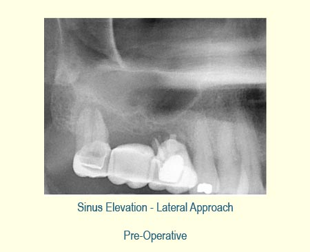 Belmont Periodontics